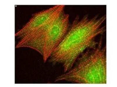 Immunocytochemistry/ Immunofluorescence: AKT1 [p Ser473] Antibody [NB600-590]